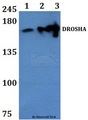 DROSHA / RNASEN Antibody - Western blot of DROSHA antibody at 1:500 dilution. Lane 1: HEPG2 whole cell lysate. Lane 2: The Brain tissue lysate of Rat. Lane 3: The Brain tissue lysate of Mouse.