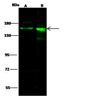 DROSHA / RNASEN Antibody - Anti-Drosha rabbit polyclonal antibody at 1:500 dilution. Lane A: Jurkat Whole Cell Lysate. Lane B: 293 Whole Cell Lysate. Lysates/proteins at 30 ug per lane. Secondary: Goat Anti-Rabbit IgG H&L (Dylight 800) at 1/10000 dilution. Developed using the Odyssey technique. Performed under reducing conditions. Predicted band size: 159 kDa. Observed band size: 159 kDa. (We are unsure as to the identity of these extra bands.)