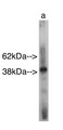Drosophila melanogaster SMSr Antibody - Western blot of Sphingomyelin Synthase r antibody on recombinant protein Lane A] antibody alone. Anti Rabbit secondary used at 1:25K Exposure for 30 seconds 