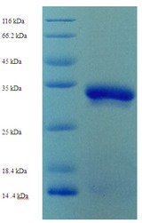 Ubc6 Protein