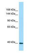 DRP2 Antibody - DRP2 antibody Western Blot of 721_B.  This image was taken for the unconjugated form of this product. Other forms have not been tested.