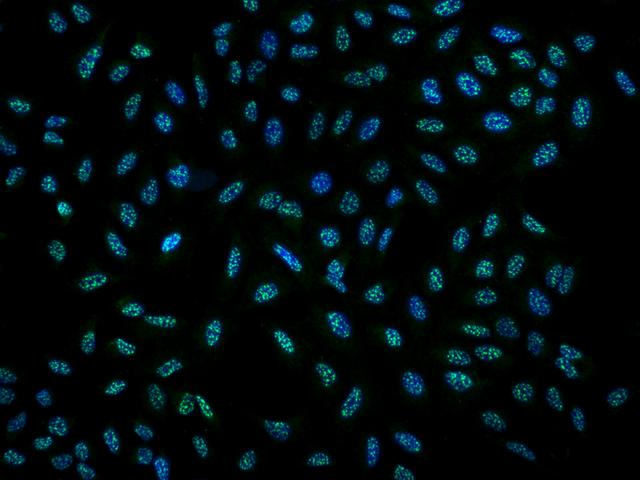 DRP2 Antibody - Immunofluorescence staining of DRP2 in U2OS cells. Cells were fixed with 4% PFA, permeabilzed with 0.3% Triton X-100 in PBS, blocked with 10% serum, and incubated with rabbit anti-Human DRP2 polyclonal antibody (dilution ratio 1:200) at 4°C overnight. Then cells were stained with the Alexa Fluor 488-conjugated Goat Anti-rabbit IgG secondary antibody (green) and counterstained with DAPI (blue). Positive staining was localized to Nucleus.