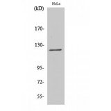DRPLA / Atrophin-1 Antibody - Western blot of Atrophin-1 antibody