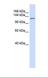 DRPLA / Atrophin-1 Antibody - Placenta lysate. Antibody concentration: 1.0 ug/ml. Gel concentration: 6-18%.  This image was taken for the unconjugated form of this product. Other forms have not been tested.