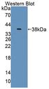 DRPLA / Atrophin-1 Antibody - Western blot of DRPLA / Atrophin-1 antibody.