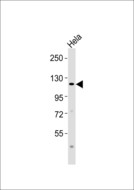 DRPLA / Atrophin-1 Antibody - Anti-Atrophin-1 Antibody at 1:1000 dilution + HeLa whole cell lysates Lysates/proteins at 20 ug per lane. Secondary Goat Anti-Rabbit IgG, (H+L),Peroxidase conjugated at 1/10000 dilution Predicted band size : 125 kDa Blocking/Dilution buffer: 5% NFDM/TBST.