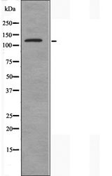 DRPLA / Atrophin-1 Antibody - Western blot analysis of extracts of HeLa cells using ATN1 antibody.