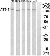 DRPLA / Atrophin-1 Antibody - Western blot analysis of extracts from HeLa cells, A549 cells, K562 cells, COLO205 cells and NIH-3T3 cells, using ATN1 antibody.