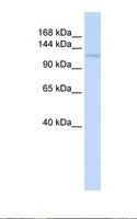 DRPLA / Atrophin-1 Antibody - 721_B cell lysate. Antibody concentration: 1.0 ug/ml. Gel concentration: 6-18%.  This image was taken for the unconjugated form of this product. Other forms have not been tested.