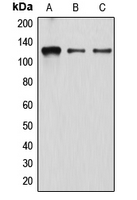DRPLA / Atrophin-1 Antibody - Western blot analysis of Atrophin-1 expression in K562 (A); EOC20 (B); HeLa (C) whole cell lysates.