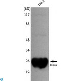dsbA Antibody - Western Blot (WB) analysis using DsbA Monoclonal Antibody against Dsba recombinant protein.