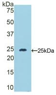 DSC1 / Desmocollin 1 Antibody - Western Blot; Sample: Recombinant DSC1, Mouse.