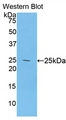 DSC1 / Desmocollin 1 Antibody - Western Blot; Sample: Recombinant protein.