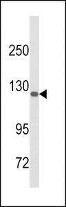 DSC1 / Desmocollin 1 Antibody - Western blot of DSC1 Antibody in A375 cell line lysates (35 ug/lane). DSC1 (arrow) was detected using the purified antibody.