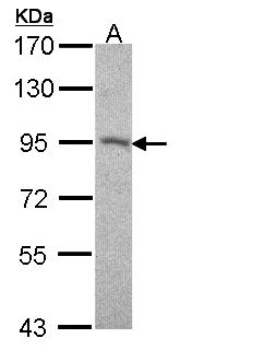 DSC2 / Desmocollin 2 Antibody - Sample (30 ug of whole cell lysate). A: A431 . 7.5% SDS PAGE. Desmocollin 2 / DSC2 antibody diluted at 1:500.