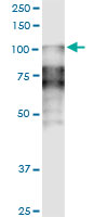 DSC2 / Desmocollin 2 Antibody - DSC2 monoclonal antibody (M14), clone 1F2. Western Blot analysis of DSC2 expression in human spleen.