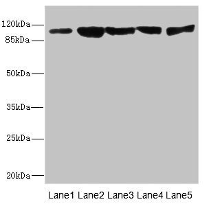 DSC2 / Desmocollin 2 Antibody - Western blot All Lanes: DSC2 antibody at 3.46ug/ml Lane 1: Rat heart tissue Lane 2: A549 whole cell lysate Lane 3: HepG-2 whole cell lysate Lane 4: Jurkat whole cell lysate Lane 5: 293T whole cell lysate Secondary Goat polyclonal to rabbit IgG at 1/10000 dilution Predicted band size: 100,94 kDa Observed band size: 100 kDa