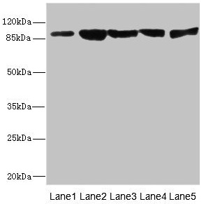 DSC2 / Desmocollin 2 Antibody - Western blot All lanes: DSC2 antibody at 3.46µg/ml Lane 1: Rat heart tissue Lane 2: A549 whole cell lysate Lane 3: HepG2 whole cell lysate Lane 4: Jurkat whole cell lysate Lane 5: 293T whole cell lysate Secondary Goat polyclonal to rabbit IgG at 1/10000 dilution Predicted band size: 100, 94 kDa Observed band size: 94 kDa