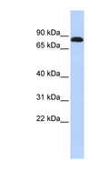 DSC3 / Desmocollin 3 Antibody - DSC3 / Desmocollin 3 antibody Western blot of Jurkat lysate. This image was taken for the unconjugated form of this product. Other forms have not been tested.