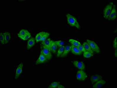 DSC3 / Desmocollin 3 Antibody - Immunofluorescence staining of HepG2 cells at a dilution of 1:133, counter-stained with DAPI. The cells were fixed in 4% formaldehyde, permeabilized using 0.2% Triton X-100 and blocked in 10% normal Goat Serum. The cells were then incubated with the antibody overnight at 4 °C.The secondary antibody was Alexa Fluor 488-congugated AffiniPure Goat Anti-Rabbit IgG (H+L) .