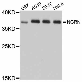 DSC92 / NGRN Antibody - Western blot analysis of extracts of various cell lines, using NGRN antibody at 1:1000 dilution. The secondary antibody used was an HRP Goat Anti-Rabbit IgG (H+L) at 1:10000 dilution. Lysates were loaded 25ug per lane and 3% nonfat dry milk in TBST was used for blocking. An ECL Kit was used for detection and the exposure time was 30s.