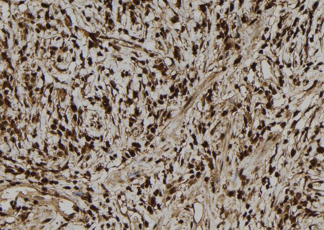 DSC92 / NGRN Antibody - 1:100 staining human gastric tissue by IHC-P. The sample was formaldehyde fixed and a heat mediated antigen retrieval step in citrate buffer was performed. The sample was then blocked and incubated with the antibody for 1.5 hours at 22°C. An HRP conjugated goat anti-rabbit antibody was used as the secondary.