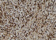 DSC92 / NGRN Antibody - 1:100 staining human gastric tissue by IHC-P. The sample was formaldehyde fixed and a heat mediated antigen retrieval step in citrate buffer was performed. The sample was then blocked and incubated with the antibody for 1.5 hours at 22°C. An HRP conjugated goat anti-rabbit antibody was used as the secondary.