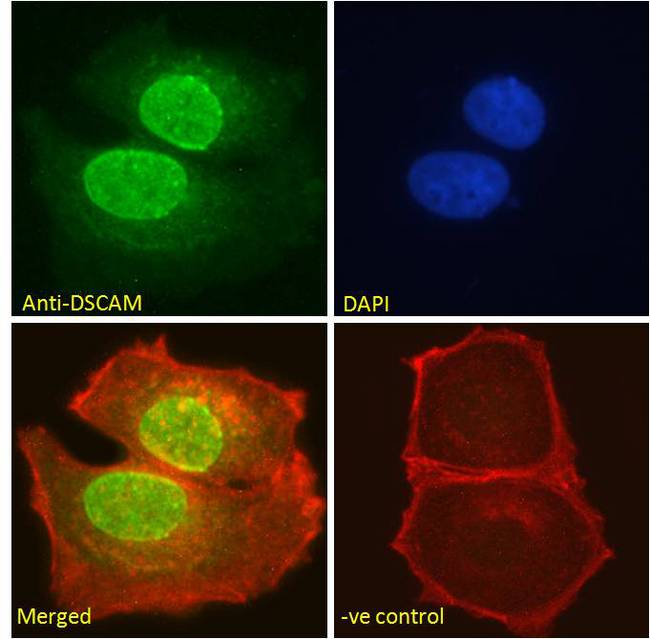 DSCAM Antibody - Goat Anti-DSCAM Antibody Immunofluorescence analysis of paraformaldehyde fixed MCF7 cells, permeabilized with 0.15% Triton. Primary incubation 1hr (10ug/ml) followed by Alexa Fluor 488 secondary antibody (2ug/ml), showing nuclear staining. Actin filaments were stained with phalloidin (red) and the nuclear stain is DAPI (blue). Negative control: Unimmunized goat IgG (10ug/ml) followed by Alexa Fluor 488 secondary antibody (2ug/ml).