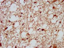 DSCAM Antibody - Immunohistochemistry image at a dilution of 1:200 and staining in paraffin-embedded human brain tissue performed on a Leica BondTM system. After dewaxing and hydration, antigen retrieval was mediated by high pressure in a citrate buffer (pH 6.0) . Section was blocked with 10% normal goat serum 30min at RT. Then primary antibody (1% BSA) was incubated at 4 °C overnight. The primary is detected by a biotinylated secondary antibody and visualized using an HRP conjugated SP system.