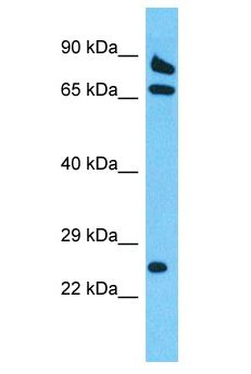DSCR3 Antibody - DSCR3 antibody Western Blot of 721_B. Antibody dilution: 1 ug/ml.  This image was taken for the unconjugated form of this product. Other forms have not been tested.