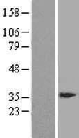 DSCR3 Protein - Western validation with an anti-DDK antibody * L: Control HEK293 lysate R: Over-expression lysate