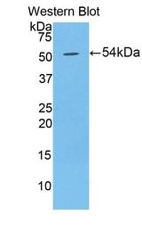 DSG1 / Desmoglein 1 Antibody - Western Blot; Sample: Recombinant protein.