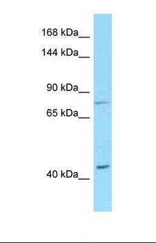 DSG1 / Desmoglein 1 Antibody - Western blot of Human U937 . DSG1 antibody dilution 1.0 ug/ml.  This image was taken for the unconjugated form of this product. Other forms have not been tested.