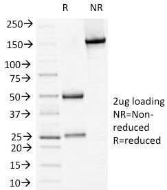 DSG1 / Desmoglein 1 Antibody - SDS-PAGE Analysis of Purified, BSA-Free Desmoglein Antibody (clone 18D4). Confirmation of Integrity and Purity of the Antibody.