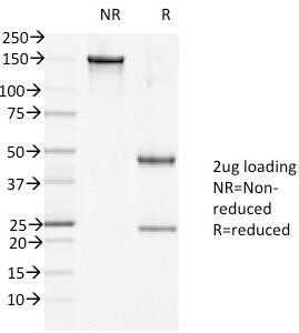 DSG1 / Desmoglein 1 Antibody - SDS-PAGE Analysis of Purified, BSA-Free DSG1 Antibody (clone 27B2). Confirmation of Integrity and Purity of the Antibody.