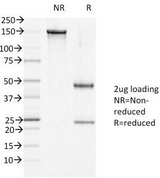 DSG1 / Desmoglein 1 Antibody - SDS-PAGE Analysis of Purified, BSA-Free DSG1 Antibody (clone 27B2). Confirmation of Integrity and Purity of the Antibody.