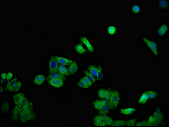 DSG1 / Desmoglein 1 Antibody - Immunofluorescent analysis of HepG2 cells at a dilution of 1:100 and Alexa Fluor 488-congugated AffiniPure Goat Anti-Rabbit IgG(H+L)