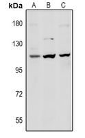 DSG1 / Desmoglein 1 Antibody - Western blot analysis of Desmoglein 1 expression in Beas2B (A), H9C2 (B), MEF (C) whole cell lysates.