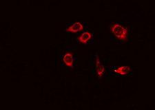 DSG1 / Desmoglein 1 Antibody - Staining 293 cells by IF/ICC. The samples were fixed with PFA and permeabilized in 0.1% Triton X-100, then blocked in 10% serum for 45 min at 25°C. The primary antibody was diluted at 1:200 and incubated with the sample for 1 hour at 37°C. An Alexa Fluor 594 conjugated goat anti-rabbit IgG (H+L) antibody, diluted at 1/600, was used as secondary antibody.