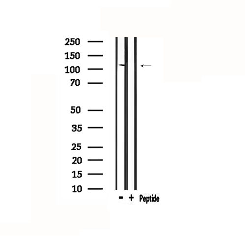 DSG1 / Desmoglein 1 Antibody - Western blot analysis of extracts of rat muscle using DSG1 antibody.