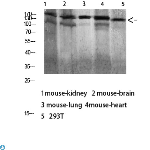 DSG1 / Desmoglein 1 Antibody - Western blot analysis of 293T lysate, antibody was diluted at 1000. Secondary antibody was diluted at 1:20000.