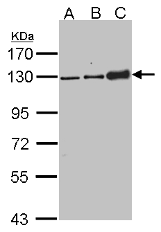 DSG2 / Desmoglein 2 Antibody - Sample (30 ug of whole cell lysate). A:293T, B: H1299, C: Molt-4 . 7.5% SDS PAGE. DSG2 / Desmoglein 2 antibody diluted at 1:1000.