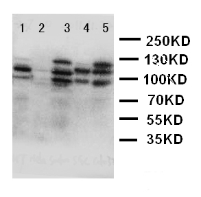 DSG2 / Desmoglein 2 Antibody - WB of DSG2 / Desmoglein 2 antibody. Lane 1: HT1080 Cell Lysate. Lane 2: HELA Cell Lysate. Lane 3: SW620 Cell Lysate. Lane 4: SCG Cell Lysate. Lane 5: COLO320 Cell Lysate.