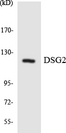 DSG2 / Desmoglein 2 Antibody - Western blot analysis of the lysates from HUVECcells using DSG2 antibody.