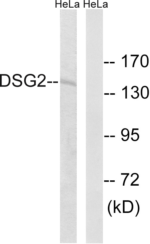 DSG2 / Desmoglein 2 Antibody - Western blot analysis of lysates from HeLa cells, using DSG2 Antibody. The lane on the right is blocked with the synthesized peptide.