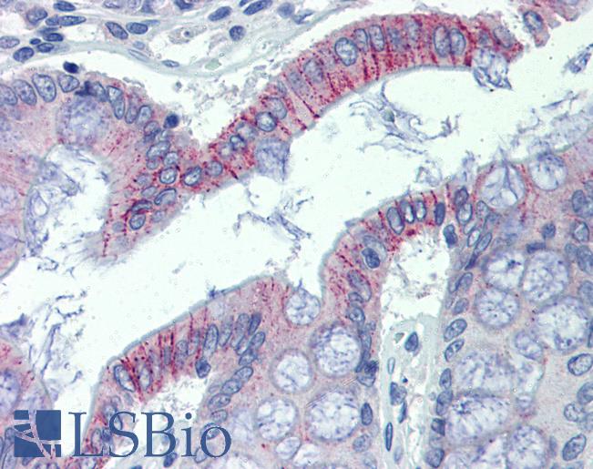 DSG2 / Desmoglein 2 Antibody - Anti-DSG2 antibody IHC of human colon. Immunohistochemistry of formalin-fixed, paraffin-embedded tissue after heat-induced antigen retrieval. Antibody concentration 5 ug/ml.  This image was taken for the unconjugated form of this product. Other forms have not been tested.