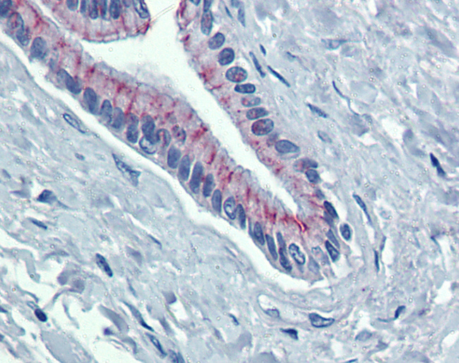 DSG2 / Desmoglein 2 Antibody - Anti-DSG2 antibody IHC of human pancreas. Immunohistochemistry of formalin-fixed, paraffin-embedded tissue after heat-induced antigen retrieval. Antibody concentration 5 ug/ml.  This image was taken for the unconjugated form of this product. Other forms have not been tested.