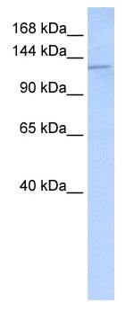 DSG2 / Desmoglein 2 Antibody - Western analysis of Hela cell lysate.  This image was taken for the unconjugated form of this product. Other forms have not been tested.