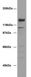 DSG2 / Desmoglein 2 Antibody