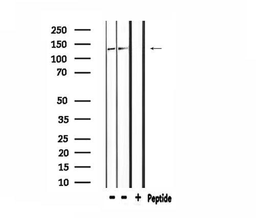 DSG2 / Desmoglein 2 Antibody - Western blot analysis of extracts of mouse brain and 293 cells using DSG2 antibody.